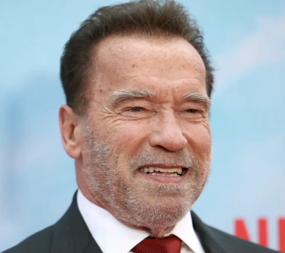 arnold_before